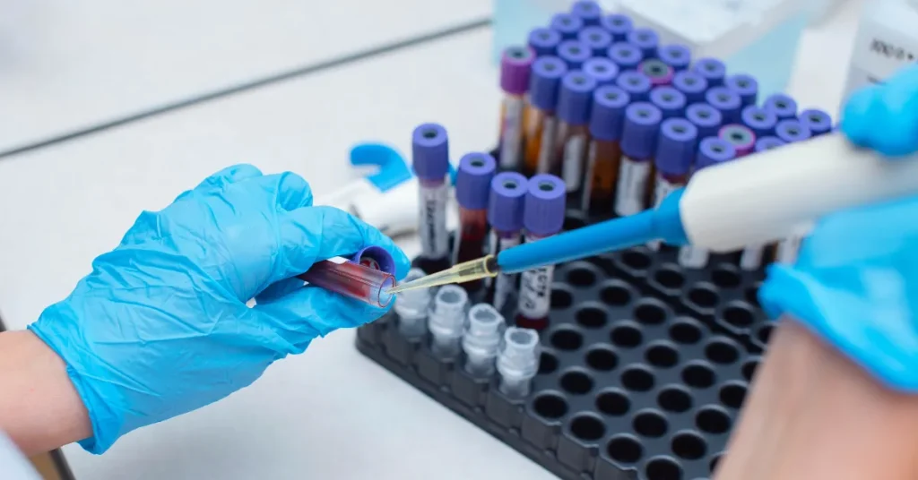 Nyt studie: Blodprøve kan identificere patienter med risiko for epilepsi